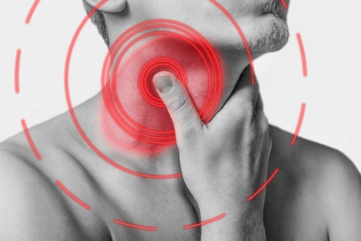 Różnice między anginą wirusową a bakteryjną